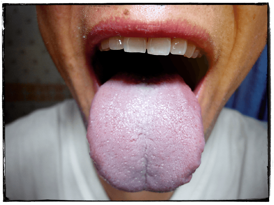 kieli komeasti ulkona suusta